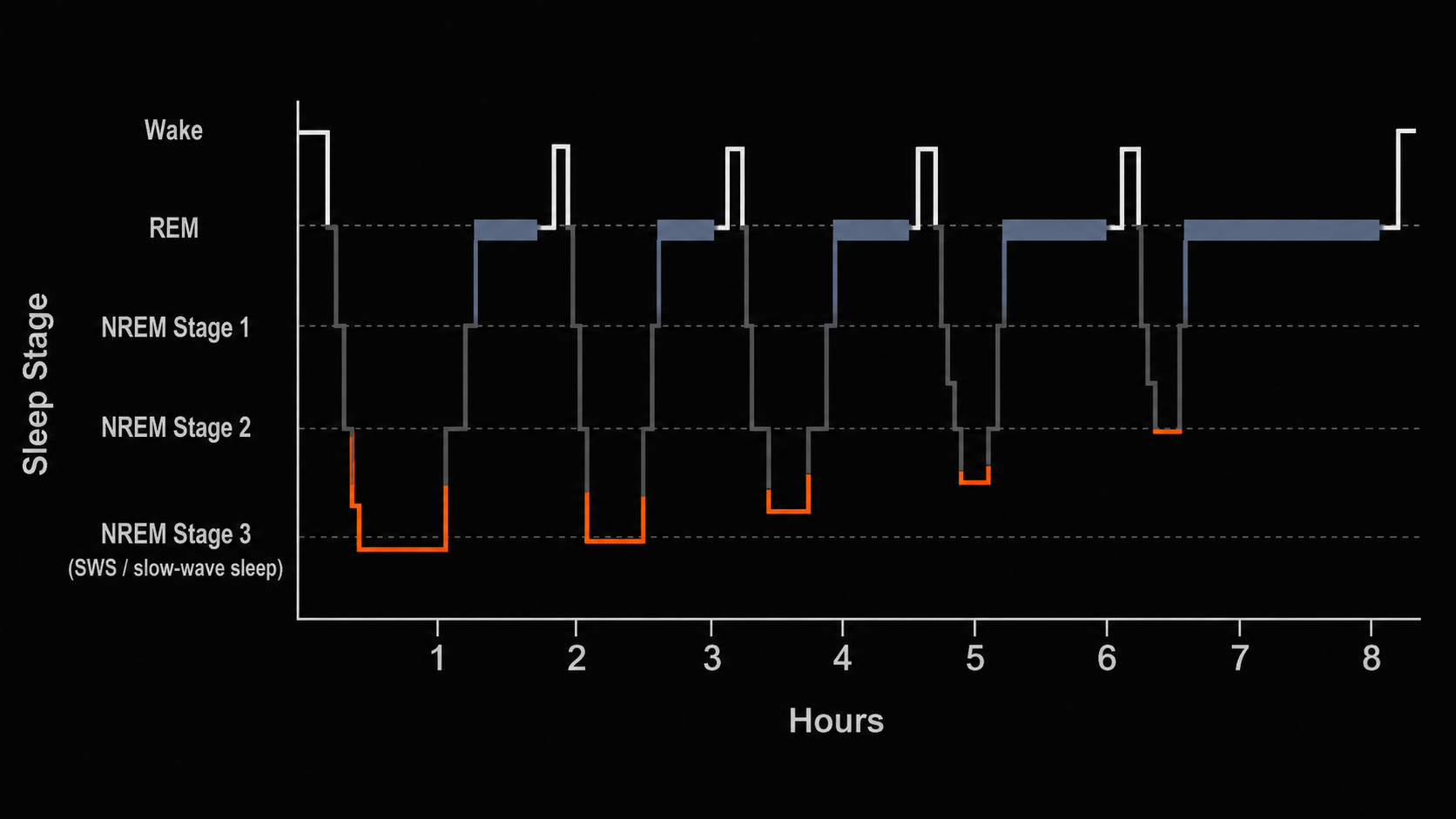 Sleep hypnogram showing SWS concentration in the first half of the night and REM concentration in the final hours